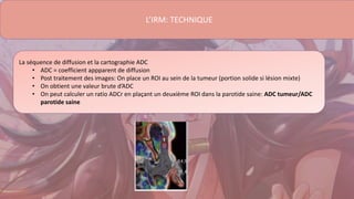 L’IRM: TECHNIQUE
La séquence de diffusion et la cartographie ADC
• ADC = coefficient appparent de diffusion
• Post traitement des images: On place un ROI au sein de la tumeur (portion solide si lésion mixte)
• On obtient une valeur brute d’ADC
• On peut calculer un ratio ADCr en plaçant un deuxième ROI dans la parotide saine: ADC tumeur/ADC
parotide saine
 