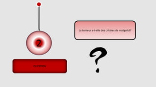 2
QUESTION
La tumeur a-t-elle des critères de malignité?
 