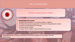 L’IRM : INTERPRETATION
La tumeur a-t-elle des critères de maligne?
 Morphologie de la tumeur:
• Le signe le plus évocateur : les contours limités, irréguliers
• L’invasion des structures adjacentes et l’extension rétrograde péri-neurale
• La présence d’adénopathie de voisinage
• L’invasion des deux lobes
• Un signal T2 bas, reflétant l’hypercellularité de la tumeur
L’hétérogéneité de la tumeur et la présence de portions kystiques ou nécrotiques n’est pas
discriminante
2
 