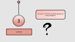 3
QUESTION
La tumeur a-t-elle des caractères typiques de
tumeur bénignes?
 