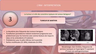L’IRM : INTERPRETATION
La tumeur a-t-elle des caractères typiques de tumeur bénignes?
• La deuxième plus fréquente des tumeurs benignes
• Tuméfaction parotidienne indolore lentement progressive avec
prédominant pour les hommes avec comme facteurs de risque le
tabac et les antécédents d’irradiation
• Prédialection pour le pôle inférieur de la parotide
• Parfois multifocales (21-38%), bilatérales (6-29%)
Morphologie: bien limitées, fréquence de
portions kystiques en hypersignal T1 spontané
(*) mais non pathognomonique
TUMEUR DE WARTHIN
3
 