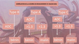 Type A
>1.3 <1.3
ADC
Type C
>1.3 <1.3
ADC
Type B
bénin
ADC
bénin malin
bénin
malin
CORRÉLATION DE LA COURBE DE REHAUSSEMENT ET VALEUR ADCr
 