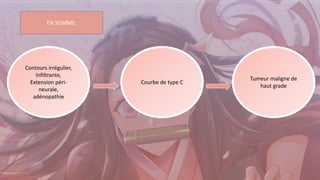 Contours irrégulier,
Infiltrante,
Extension péri-
neurale,
adénopathie
Courbe de type C
Tumeur maligne de
haut grade
EN SOMME:
 