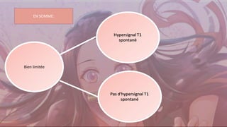 Bien limitée
EN SOMME:
 