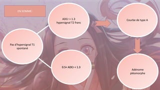 Pas d’hypersignal T1
spontané
ADCr > 1.3
hypersignal T2 franc
Courbe de type A
Adénome
pléomorphe
EN SOMME:
 