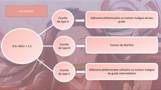 0.5< ADCr < 1.3
Adénome phléomorphe ou tumeur maligne de bas
grade
Tumeur de Warthin
Adénome phléomorphe cellulaire ou tumeur maligne
de grade intermédiaire
Courbe
de type A
Courbe
de type B
Courbe
de type C
EN SOMME:
 