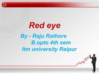 Red eye
By - Raju Rathore
B.opto 4th sem
Itm university Raipur
 