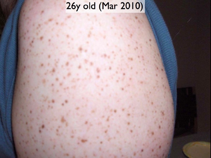 The Rast of the Story (Cardiology 2011)