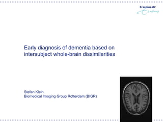 Early diagnosis of dementia based on intersubject whole-brain dissimilarities  Stefan Klein Biomedical Imaging Group Rotterdam (BIGR) 