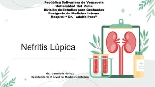 Nefritis Lùpica
Mc: Jamileth Núñez
Residente de 2 nivel de Medicina Interna
República Bolivariana de Venezuela
Universidad del Zulia
División de Estudios para Graduados
Postgrado de Medicina Interna
Hospital “ Dr. Adolfo Pons”
 