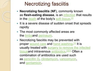 Necrotizing fasciitis Case presentation 