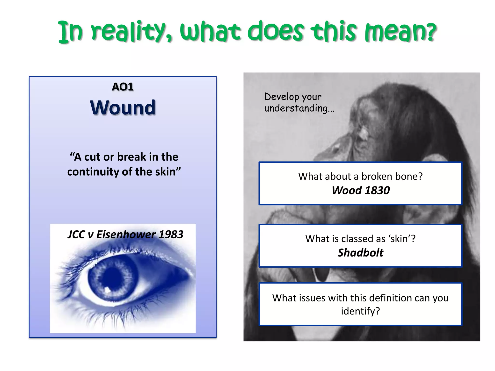 In reality, what does this mean?

         AO1
                          Develop your
    Wound                 understanding...




“A cut or break in the
continuity of the skin”          What about a broken bone?
                                         Wood 1830


JCC v Eisenhower 1983              What is classed as ‘skin’?
                                             Shadbolt


                           What issues with this definition can you
                                          identify?
 