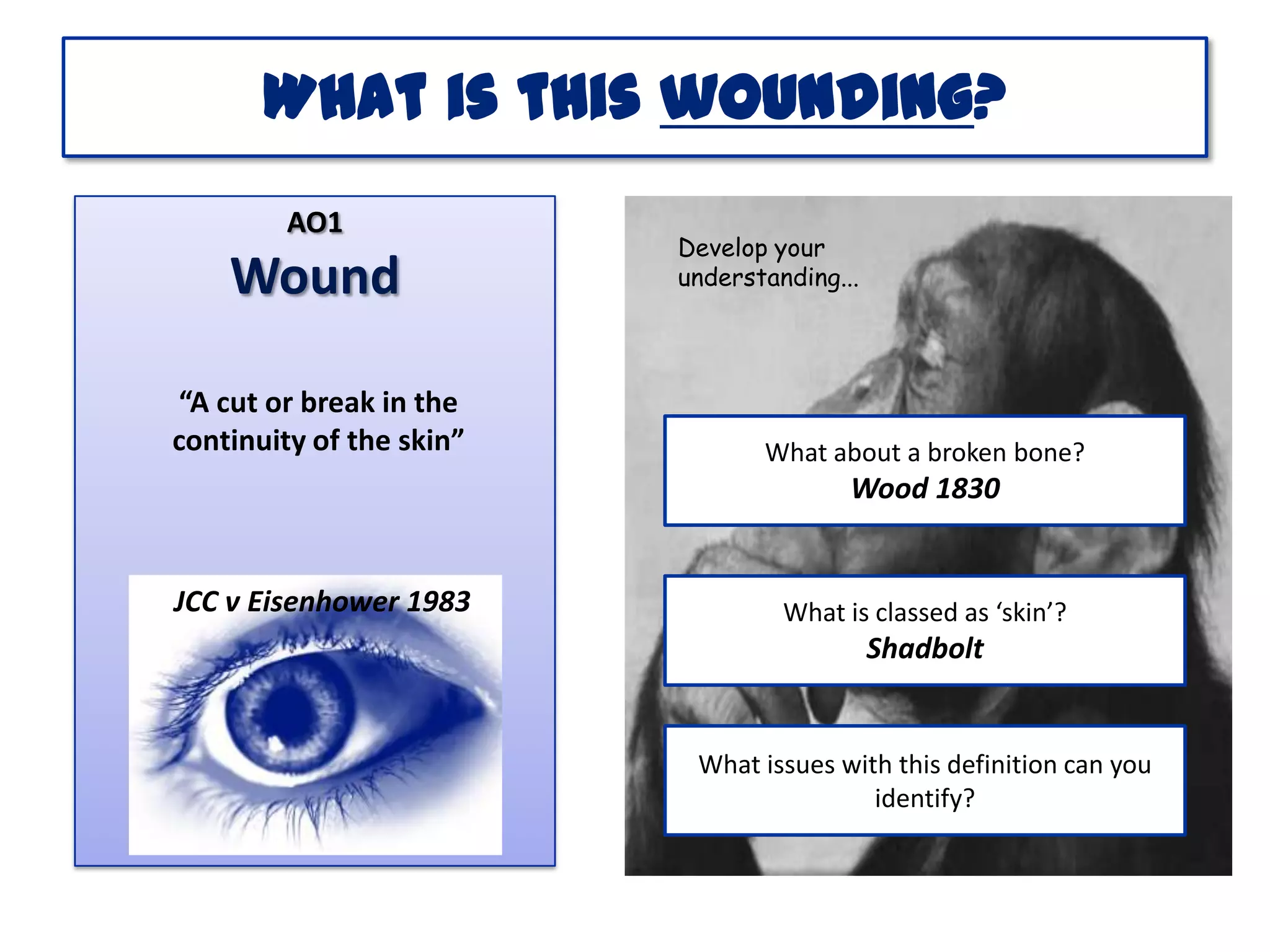 What is this wounding?
AO1

Wound
“A cut or break in the
continuity of the skin”

Develop your
understanding...

What about a broken bone?

Wood 1830

JCC v Eisenhower 1983

What is classed as ‘skin’?

Shadbolt

What issues with this definition can you
identify?

 