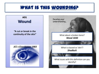 What is this wounding?
AO1

Wound
“A cut or break in the
continuity of the skin”

Develop your
understanding...

What about a broken bone?

Wood 1830

JCC v Eisenhower 1983

What is classed as ‘skin’?

Shadbolt

What issues with this definition can you
identify?

 
