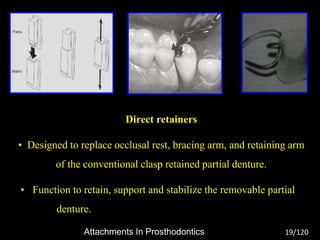 Attachments In Prosthodontics | PPTX