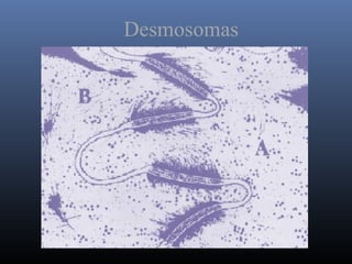 Desmosomas
 