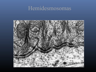 Hemidesmosomas
 