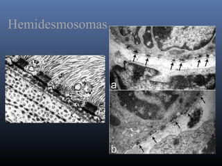 Hemidesmosomas
 
