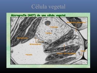 Célula vegetal
 