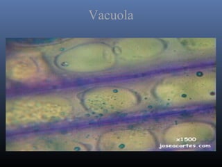 Vacuola
 