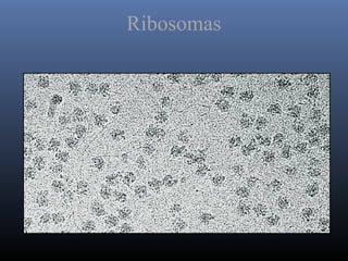 Ribosomas
 