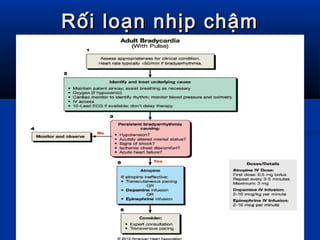 Rối loạn nhịp chậmRối loạn nhịp chậm
 