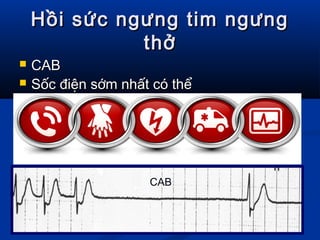 Hồi sức ngưng tim ngưngHồi sức ngưng tim ngưng
thởthở
 CABCAB
 Sốc điện sớm nhất có thểSốc điện sớm nhất có thể
CAB
 