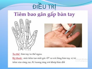 ĐI U TR
Ề Ị
 