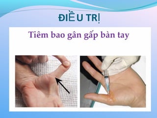 ĐI U TR
Ề Ị
 