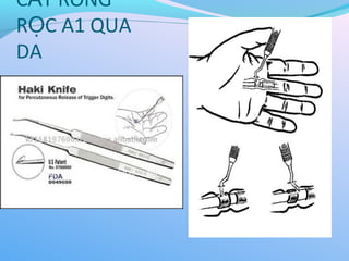 C T RÒNG
Ắ
R C A1 QUA
Ọ
DA
 