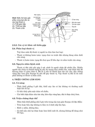 132
M¹c ngang
L¸ tr−íc bao
c¬ th¼ng
bông
Bã m¹ch
th−îng vÞ d−íi
§−êng tr¾ng
bªn
L¸ sau bao c¬
th¼ng bông
Lç bÑn n«ng
§M chËu ngoµi
TM chËu ngoµi
èng ®ïi
D©y ch»ng
Cooper
(1)
(2) (3)
H×nh 12.5. S¬ l−îc gi¶i
phÉu vïng bÑn-®ïi vµ
c¸c lo¹i tho¸t vÞ:
(1).TVB gi¸n tiÕp
(2). TVB trùc tiÕp
(3). Tho¸t vÞ ®ïi
2.3.2. C¸c vÞ trÝ kh¸c rÊt hiÕm gÆp
2.4. Ph©n lo¹i tho¸t vÞ
Tuú theo møc ®é tho¸t vÞ ng−êi ta chia lµm hai lo¹i:
− Tho¸t vÞ kh«ng hoµn toµn: t¹ng chui ra tr−íc ®ïi nh−ng ®ang n»m d−íi
c©n sµng.
− Tho¸t vÞ hoµn toµn: t¹ng ®· chui qua lç bÇu dôc vµ n»m tr−íc c©n sµng.
2.3. Nguyªn nh©n bÖnh sinh
Tho¸t vÞ ®ïi chñ yÕu gÆp ë n÷, nhÊt lµ ng−êi chöa ®Î nhiÒu lÇn. NhiÒu
ng−êi cho r»ng c¬ thµnh bông bÞ yÕu do mang thai nhiÒu lÇn, mÆt kh¸c khi ®Î
khung chËu co gi·n chót Ýt. §ã lµ 2 yÕu tè chÝnh lµm cho c¸c c©n, d©y ch»ng
vïng ®¸y tam gi¸c Scarpa bÞ yÕu dÔ g©y tho¸t vÞ. VËy tho¸t vÞ ®ïi lµ do m¾c
ph¶i kh«ng cã tho¸t vÞ bÈm sinh.
4. TriÖu chøng l©m sµng
4.1. C¬ n¨ng
− ThÊy khèi phång ë gèc ®ïi, khèi nµy lóc cã lóc kh«ng vµ th−êng xuÊt
hiÖn khi ®i l¹i.
− Cã khi thÊy phï mét ch©n vÒ chiÒu.
− C¸c biÓu hiÖn kh¸c nh− tøc nhÑ, khã chÞu vïng bÑn, ®ïi Ýt ®−îc chó ý h¬n.
4.2. TriÖu chøng thùc thÓ
Nh×n thÊy khèi phång nhá ë gãc trªn trong cña tam gi¸c Scarpa víi ®Æc ®iÓm:
− Trßn hoÆc bÇu dôc kh«ng to l¾m vµ ë d−íi nÕp l»n bÑn.
− Khèi u mÒm, kh«ng ®au.
− Cã thÓ n¾n nhá l¹i ®−îc hoÆc lµm khèi mÊt ®i, nh−ng kh«ng dÔ dµng nh−
TV bÑn.
 