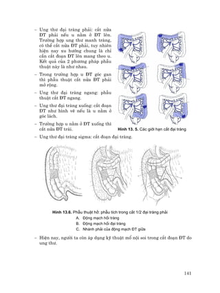141
− Ung th− ®¹i trµng ph¶i: c¾t nöa
§T ph¶i nÕu u n»m ë §T lªn.
Tr−êng hîp ung th− manh trµng,
cã thÓ c¾t nöa §T ph¶i, tuy nhiªn
hiÖn nay xu h−íng chung lµ chØ
cÇn c¾t ®o¹n §T lªn mang theo u.
KÕt qu¶ cña 2 ph−¬ng ph¸p phÉu
thuËt nµy lµ nh− nhau.
− Trong tr−êng hîp u §T gãc gan
th× phÉu thuËt c¾t nöa §T ph¶i
më réng.
− Ung th− ®¹i trµng ngang: phÉu
thuËt c¾t §T ngang.
− Ung th− ®¹i trµng xuèng: c¾t ®o¹n
§T nh− h×nh vÏ nÕu lµ u n»m ë
gãc l¸ch.
− Tr−êng hîp u n»m ë §T xuèng th×
c¾t nöa §T tr¸i. H×nh 13. 5. C¸c giíi h¹n c¾t ®¹i trµng
− Ung th− ®¹i trµng sigma: c¾t ®o¹n ®¹i trµng.
H×nh 13.6. PhÉu thuËt hë: phÉu tÝch trong c¾t 1/2 ®¹i trµng ph¶i
A. §éng m¹ch håi trµng
B. §éng m¹ch håi ®¹i trµng
C. Nh¸nh ph¶i cña ®éng m¹ch §T gi÷a
− HiÖn nay, ng−êi ta cßn ¸p dông kü thuËt mæ néi soi trong c¾t ®o¹n §T do
ung th−.
 