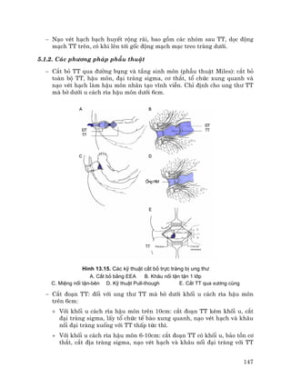 147
− N¹o vÐt h¹ch b¹ch huyÕt réng r·i, bao gåm c¸c nhãm sau TT, däc ®éng
m¹ch TT trªn, cã khi lªn tíi gèc ®éng m¹ch m¹c treo trµng d−íi.
5.1.2. C¸c ph−¬ng ph¸p phÉu thuËt
− C¾t bá TT qua ®−êng bông vµ tÇng sinh m«n (phÉu thuËt Miles): c¾t bá
toµn bé TT, hËu m«n, ®¹i trµng sigma, c¬ th¾t, tæ chøc xung quanh vµ
n¹o vÐt h¹ch lµm hËu m«n nh©n t¹o vÜnh viÔn. ChØ ®Þnh cho ung th− TT
mµ bê d−íi u c¸ch r×a hËu m«n d−íi 6cm.
H×nh 13.15. C¸c kü thuËt c¾t bá trùc trµng bÞ ung th−
A. C¾t bá b»ng EEA B. Kh©u nèi tËn tËn 1 líp
C. MiÖng nèi tËn-bªn D. Kü thuËt Pull-though E. C¾t TT qua x−¬ng cïng
− C¾t ®o¹n TT: ®èi víi ung th− TT mµ bê d−íi khèi u c¸ch r×a hËu m«n
trªn 6cm:
+ Víi khèi u c¸ch r×a hËu m«n trªn 10cm: c¾t ®o¹n TT kÌm khèi u, c¾t
®¹i trµng sigma, lÊy tæ chøc tÕ bµo xung quanh, n¹o vÐt h¹ch vµ kh©u
nèi ®¹i trµng xuèng víi TT thÊp tøc th×.
+ Víi khèi u c¸ch r×a hËu m«n 6-10cm: c¾t ®o¹n TT cã khèi u, b¶o tån c¬
th¾t, c¾t ®Þa trµng sigma, n¹o vÐt h¹ch vµ kh©u nèi ®¹i trµng víi TT
§T
TT
§T
TT
èng HM
TT
 