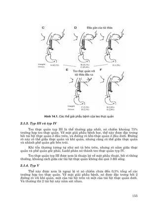 155
H×nh 14.1. C¸c thÓ gi¶i phÉu bÖnh cña teo thùc qu¶n
2.1.3. Typ III vµ typ IV
Teo thùc qu¶n typ III lµ thÓ th−êng gÆp nhÊt, nã chiÕm kho¶ng 75%
tr−êng hîp teo thùc qu¶n. VÒ mÆt gi¶i phÉu bÖnh häc, thÓ nµy ®−îc ®Æc tr−ng
bëi tói bÞt thùc qu¶n ë ®Çu trªn, vµ ®−êng rß khÝ-thùc qu¶n ë ®Çu d−íi. §−êng
rß nµy cã thÓ gi÷a thùc qu¶n vµ khÝ qu¶n, nh−ng còng cã thÓ gi÷a thùc qu¶n
vµ nh¸nh phÕ qu¶n gèc bªn tr¸i.
Khi tæn th−¬ng t−¬ng tù nh− m« t¶ bªn trªn, nh−ng rß n»m gi÷a thùc
qu¶n vµ phÕ qu¶n gèc ph¶i, Ladd ph©n nã thµnh teo thùc qu¶n typ IV.
Teo thùc qu¶n typ III ®−îc xem lµ thuËn lîi vÒ mÆt phÉu thuËt, bëi v× th«ng
th−êng, kho¶ng c¸ch gi÷a c¸c tói bÞt thùc qu¶n kh«ng dµi qu¸ 3 ®èt sèng.
2.1.4. Typ V
ThÓ nµy ®−îc xem lµ ngo¹i lÖ v× nã chiÕm ch−a ®Õn 0,5% tæng sè c¸c
tr−êng hîp teo thùc qu¶n. VÒ mÆt gi¶i phÉu bÖnh, nã ®−îc ®Æc tr−ng bëi 2
®−êng rß víi khÝ qu¶n, mét cña tói bÞt trªn vµ mét cña tói bÞt thùc qu¶n d−íi.
Vµ th−êng th× 2 tói bÞt nµy n»m s¸t nhau.
§Çu gÇn cña tói thõa
Teo thùc qu¶n víi
tói thõa ®Çu xa
B (22,1%)
C (85,4%)
A (62,1%) E (1,2%)
C (2,1%)
D (2,1%)
H (2,8%)
E (2,8%)
 