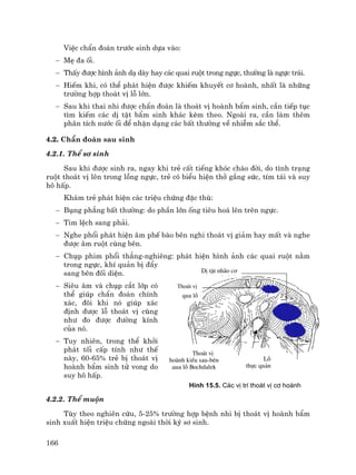 166
ViÖc chÈn ®o¸n tr−íc sinh dùa vµo:
− MÑ ®a èi.
− ThÊy ®−îc h×nh ¶nh d¹ dµy hay c¸c quai ruét trong ngùc, th−êng lµ ngùc tr¸i.
− HiÕm khi, cã thÓ ph¸t hiÖn ®−îc khiÕm khuyÕt c¬ hoµnh, nhÊt lµ nh÷ng
tr−êng hîp tho¸t vÞ lç lín.
− Sau khi thai nhi ®−îc chÈn ®o¸n lµ tho¸t vÞ hoµnh bÈm sinh, cÇn tiÕp tôc
t×m kiÕm c¸c dÞ tËt bÈm sinh kh¸c kÌm theo. Ngoµi ra, cÇn lµm thªm
ph©n tÝch n−íc èi ®Ó nhËn d¹ng c¸c bÊt th−êng vÒ nhiÔm s¾c thÓ.
4.2. ChÈn ®o¸n sau sinh
4.2.1. ThÓ s¬ sinh
Sau khi ®−îc sinh ra, ngay khi trÎ cÊt tiÕng khãc chµo ®êi, do t×nh tr¹ng
ruét tho¸t vÞ lªn trong lång ngùc, trÎ cã biÓu hiÖn thë g¾ng søc, tÝm t¸i vµ suy
h« hÊp.
Kh¸m trÎ ph¸t hiÖn c¸c triÖu chøng ®Æc thï:
− Bông ph¼ng bÊt th−êng: do phÇn lín èng tiªu ho¸ lªn trªn ngùc.
− Tim lÖch sang ph¶i.
− Nghe phæi ph¸t hiÖn ©m phÕ bµo bªn nghi tho¸t vÞ gi¶m hay mÊt vµ nghe
®−îc ©m ruét cïng bªn.
− Chôp phim phæi th¼ng-nghiªng: ph¸t hiÖn h×nh ¶nh c¸c quai ruét n»m
trong ngùc, khÝ qu¶n bÞ ®Èy
sang bªn ®èi diÖn.
− Siªu ©m vµ chôp c¾t líp cã
thÓ gióp chÈn ®o¸n chÝnh
x¸c, ®«i khi nã gióp x¸c
®Þnh ®−îc lç tho¸t vÞ còng
nh− ®o ®−îc ®−êng kÝnh
cña nã.
− Tuy nhiªn, trong thÓ khëi
ph¸t tèi cÊp tÝnh nh− thÕ
nµy, 60-65% trÎ bÞ tho¸t vÞ
hoµnh bÈm sinh tö vong do
suy h« hÊp.
H×nh 15.5. C¸c vÞ trÝ tho¸t vÞ c¬ hoµnh
4.2.2. ThÓ muén
Tïy theo nghiªn cøu, 5-25% tr−êng hîp bÖnh nhi bÞ tho¸t vÞ hoµnh bÈm
sinh xuÊt hiÖn triÖu chøng ngoµi thêi kú s¬ sinh.
DÞ tËt nh·o c¬
h µ h
TV
qua lç
Tho¸t vÞ
hoµnh kiÓu sau-bªn
qua lç Bochdalek
Lç
thùc qu¶n
Tho¸t vÞ
 