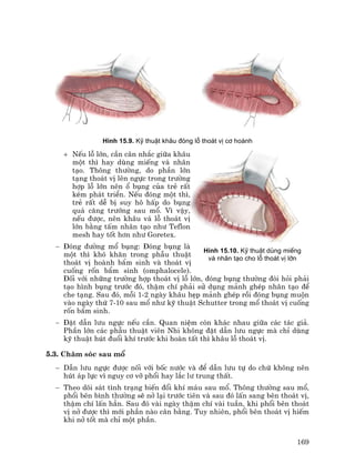 169
H×nh 15.9. Kü thuËt kh©u ®ãng lç tho¸t vÞ c¬ hoµnh
+ NÕu lç lín, cÇn c©n nh¾c gi÷a kh©u
mét th× hay dïng miÕng v¸ nh©n
t¹o. Th«ng th−êng, do phÇn lín
t¹ng tho¸t vÞ lªn ngùc trong tr−êng
hîp lç lín nªn æ bông cña trÎ rÊt
kÐm ph¸t triÓn. NÕu ®ãng mét th×,
trÎ rÊt dÔ bÞ suy h« hÊp do bông
qu¸ c¨ng tr−íng sau mæ. V× vËy,
nÕu ®−îc, nªn kh©u v¸ lç tho¸t vÞ
lín b»ng tÊm nh©n t¹o nh− Teflon
mesh hay tèt h¬n nh− Goretex.
− §ãng ®−êng mæ bông: §ãng bông lµ
mét th× khã kh¨n trong phÉu thuËt
tho¸t vÞ hoµnh bÈm sinh vµ tho¸t vÞ
cuèng rèn bÈm sinh (omphalocele).
§èi víi nh÷ng tr−êng hîp tho¸t vÞ lç lín, ®ãng bông th−êng ®ßi hái ph¶i
t¹o h×nh bông tr−íc ®ã, thËm chÝ ph¶i sö dông m¶nh ghÐp nh©n t¹o ®Ó
che t¹ng. Sau ®ã, mçi 1-2 ngµy kh©u hÑp m¶nh ghÐp råi ®ãng bông muén
vµo ngµy thø 7-10 sau mæ nh− kü thuËt Schutter trong mæ tho¸t vÞ cuèng
rèn bÈm sinh.
− §Æt dÉn l−u ngùc nÕu cÇn. Quan niÖm cßn kh¸c nhau gi÷a c¸c t¸c gi¶.
PhÇn lín c¸c phÉu thuËt viªn Nhi kh«ng ®Æt dÉn l−u ngùc mµ chØ dïng
kü thuËt hót ®uæi khÝ tr−íc khi hoµn tÊt th× kh©u lç tho¸t vÞ.
5.3. Ch¨m sãc sau mæ
− DÉn l−u ngùc ®−îc nèi víi bèc n−íc vµ ®Ó dÉn l−u tù do chø kh«ng nªn
hót ¸p lùc v× nguy c¬ vì phæi hay l¾c l− trung thÊt.
− Theo dâi s¸t t×nh tr¹ng biÕn ®æi khÝ m¸u sau mæ. Th«ng th−êng sau mæ,
phæi bªn b×nh th−êng sÏ në l¹i tr−íc tiªn vµ sau ®ã lÊn sang bªn tho¸t vÞ,
thËm chÝ lÊn h¼n. Sau ®ã vµi ngµy thËm chÝ vµi tuÇn, khi phæi bªn tho¸t
vÞ në ®−îc th× míi phÇn nµo c©n b»ng. Tuy nhiªn, phæi bªn tho¸t vÞ hiÕm
khi në tèt mµ chØ mét phÇn.
H×nh 15.10. Kü thuËt dïng miÕng
v¸ nh©n t¹o cho lç tho¸t vÞ lín
 