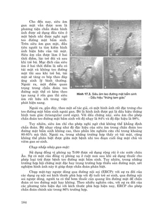 184
Cho ®Õn nay, siªu ©m
gan mËt vÉn ®−îc xem lµ
ph−¬ng tiÖn chÈn ®o¸n h×nh
¶nh ®−îc sö dông ®Çu tiªn ë
mét bÖnh nhi ®−îc nghi ngê
teo ®−êng mËt bÈm sinh.
Trªn siªu ©m gan mËt, ®Çu
tiªn ng−êi ta t×m kiÕm h×nh
¶nh hiÖn h÷u cña tói mËt.
Siªu ©m cÇn ®−îc lµm ë hai
thêi ®iÓm, lóc trÎ ®ãi vµ sau
khi trÎ bó. Môc ®Ých cña siªu
©m ë hai thêi ®iÓm lµ nÕu cã
tói mËt vµ kh«ng teo ®−êng
mËt th× sau khi trÎ bó, tói
mËt sÏ t¨ng co bãp theo ®¸p
øng sinh lý b×nh th−êng.
Ngoµi ra, mét ®iÓm quan
träng trong chÈn ®o¸n teo
®−êng mËt thÓ cã kÌm theo
t¹o nang ë rèn gan th× siªu
©m rÊt h÷u Ých trong viÖc
ph¸t hiÖn nang.
Ngoµi ra, gÇn ®©y, theo mét sè t¸c gi¶, cã mét h×nh ¶nh rÊt ®Æc tr−ng cho
teo ®−êng mËt bÈm sinh ngoµi gan. §ã lµ h×nh ¶nh ®−îc gäi lµ dÊu hiÖu thõng
h×nh tam gi¸c (triangular cord sign). Víi dÊu chøng nµy, siªu ©m cho phÐp
chÈn ®o¸n teo ®−êng mËt bÈm sinh víi ®é nh¹y lµ 84% vµ ®é ®Æc hiÖu lµ 98%.
Tuy nhiªn, siªu ©m chØ cho phÐp nghi ngê chø kh«ng thÓ kh¼ng ®Þnh
chÈn ®o¸n. §é nh¹y còng nh− ®é ®Æc hiÖu cña siªu ©m trong chÈn ®o¸n teo
®−êng mËt bÈm sinh kh«ng cao, theo phÇn lín nghiªn cøu chØ trong kho¶ng
80-85% mµ th«i. Ngoµi ra, trong nh÷ng tr−êng hîp thÊy cã tói mËt, còng
kh«ng thÓ ph©n biÖt ®−îc gi÷a mét bÖnh nhi teo ®o¹n cuèi èng mËt chñ vµ
viªm gan s¬ sinh.
Chôp nhÊp nh¸y gan-mËt:
Sö dông ®ång vÞ phãng x¹ Tc99 ®−îc sö dông réng r·i ë c¸c n−íc ch©u
¢u. Sù cã mÆt cña ®ång vÞ phãng x¹ ë ruét non sau khi sö dông thuèc cho
phÐp lo¹i trõ ®−îc bÖnh teo ®−êng mËt bÈm sinh. Tuy nhiªn, trong nh÷ng
tr−êng hîp héi chøng mËt ®Æc hay trong tr−êng hîp thiÓu s¶n ®−êng mËt, xÐt
nghiÖm h×nh ¶nh nµy Ýt gióp ®−îc chÈn ®o¸n ph©n biÖt.
Chôp mËt-tôy ng−îc dßng qua ®−êng néi soi (ERCP): víi sù ra ®êi cña
c¸c dông cô néi soi kÝch th−íc phï hîp víi ®é tuæi trÎ s¬ sinh, qua ®−êng néi
soi ng−îc dßng, ng−êi ta cã thÓ b¬m thuèc c¶n quang lªn ®−êng mËt ®Ó chÈn
®o¸n cã teo ®−êng mËt hay kh«ng. Theo nhiÒu nghiªn cøu, víi sù ra ®êi cña
c¸c ph−¬ng tiªn hiÖn ®¹i víi kÝch th−íc phï hîp hiÖn nay, ERCP cho phÐp
chÈn ®o¸n chÝnh x¸c trong 86% tr−êng hîp.
H×nh 17.3. Siªu ©m teo ®−êng mËt bÈm sinh
- DÊu hiÖu "thõng tam gi¸c”
 