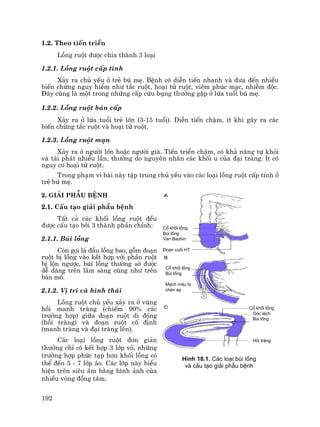 192
1.2. Theo tiÕn triÓn
Lång ruét ®−îc chia thµnh 3 lo¹i
1.2.1. Lång ruét cÊp tÝnh
X¶y ra chñ yÕu ë trÎ bó mÑ. BÖnh cã diÔn tiÕn nhanh vµ ®−a ®Õn nhiÒu
biÕn chøng nguy hiÓm nh− t¾c ruét, ho¹i tö ruét, viªm phóc m¹c, nhiÔm ®éc.
§©y còng lµ mét trong nh÷ng cÊp cøu bông th−êng gÆp ë løa tuæi bó mÑ.
1.2.2. Lång ruét b¸n cÊp
X¶y ra ë løa tuæi trÎ lín (3-15 tuæi). DiÔn tiÕn chËm, Ýt khi g©y ra c¸c
biÕn chøng t¾c ruét vµ ho¹i tö ruét.
1.2.3. Lång ruét m¹n
X¶y ra ë ng−êi lín hoÆc ng−êi giµ. TiÕn triÓn chËm, cã kh¶ n¨ng tù khái
vµ t¸i ph¸t nhiÒu lÇn, th−êng do nguyªn nh©n c¸c khèi u cña ®¹i trµng. Ýt cã
nguy c¬ ho¹i tö ruét.
Trong ph¹m vi bµi nµy tËp trung chñ yÕu vµo c¸c lo¹i lång ruét cÊp tÝnh ë
trÎ bó mÑ.
2. Gi¶i phÉu bÖnh
2.1. CÊu t¹o gi¶i phÉu bÖnh
TÊt c¶ c¸c khèi lång ruét ®Òu
®−îc cÊu t¹o bëi 3 thµnh phÇn chÝnh:
2.1.1. Bói lång
Cßn gäi lµ ®Çu lång bao, gåm ®o¹n
ruét bÞ lång vµo kÕt hîp víi phÇn ruét
bÞ lén ng−îc, bói lång th−êng sê ®−îc
dÔ dµng trªn l©m sµng còng nh− trªn
bµn mæ.
2.1.2. VÞ trÝ vµ h×nh th¸i
Lång ruét chñ yÕu x¶y ra ë vïng
håi manh trµng (chiÕm 90% c¸c
tr−êng hîp) gi÷a ®o¹n ruét di ®éng
(håi trµng) vµ ®o¹n ruét cè ®Þnh
(manh trµng vµ ®¹i trµng lªn).
C¸c lo¹i lång ruét ®¬n gi¶n
th−êng chØ cã kÕt hîp 3 líp vá, nh÷ng
tr−êng hîp phøc t¹p h¬n khèi lång cã
thÓ ®Õn 5 - 7 líp ¸o. C¸c líp nµy biÓu
hiÖn trªn siªu ©m b»ng h×nh ¶nh cña
nhiÒu vßng ®ång t©m.
Cæ khèi lång
Bói lång
Van Bauhin
§o¹n cuèi HT
Cæ khèi lång
Bói lång
M¹ch m¸u bÞ
chÌn Ðp
Cæ khèi lång
Gãc l¸ch
Bói lång
Håi trµng
H×nh 18.1. C¸c lo¹i bói lång
vµ cÊu t¹o gi¶i phÉu bÖnh
 