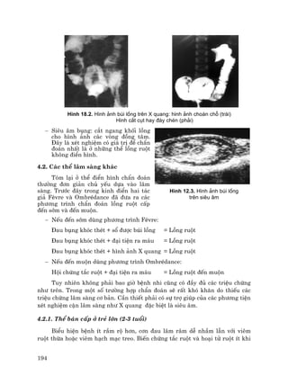 194
H×nh 18.2. H×nh ¶nh bói lång trªn X quang: h×nh ¶nh cho¸n chç (tr¸i)
H×nh c¾t côt hay ®¸y chÐn (ph¶i)
− Siªu ©m bông: c¾t ngang khèi lång
cho h×nh ¶nh c¸c vßng ®ång t©m.
§©y lµ xÐt nghiÖm cã gi¸ trÞ ®Ó chÈn
®o¸n nhÊt lµ ë nh÷ng thÓ lång ruét
kh«ng ®iÓn h×nh.
4.2. C¸c thÓ l©m sµng kh¸c
Tãm l¹i ë thÓ ®iÓn h×nh chÈn ®o¸n
th−êng ®¬n gi¶n chñ yÕu dùa vµo l©m
sµng. Tr−íc ®©y trong kinh ®iÓn hai t¸c
gi¶ FÌvre vµ OmbrÐdance ®· ®−a ra c¸c
ph−¬ng tr×nh chÈn ®o¸n lång ruét cÊp
®Õn sím vµ ®Õn muén.
− NÕu ®Õn sím dïng ph−¬ng tr×nh FÌvre:
§au bông khãc thÐt + sæ ®−îc bói lång = Lång ruét
§au bông khãc thÐt + ®¹i tiÖn ra m¸u = Lång ruét
§au bông khãc thÐt + h×nh ¶nh X quang = Lång ruét
− NÕu ®Õn muén dïng ph−¬ng tr×nh OmbrÐdance:
Héi chøng t¾c ruét + ®¹i tiÖn ra m¸u = Lång ruét ®Õn muén
Tuy nhiªn kh«ng ph¶i bao giê bÖnh nhi còng cã ®Çy ®ñ c¸c triÖu chøng
nh− trªn. Trong mét sè tr−êng hîp chÈn ®o¸n sÏ rÊt khã kh¨n do thiÕu c¸c
triÖu chøng l©m sµng c¬ b¶n. CÇn thiÕt ph¶i cã sù trî gióp cña c¸c ph−¬ng tiÖn
xÐt nghiÖm cËn l©m sµng nh− X quang ®Æc biÖt lµ siªu ©m.
4.2.1. ThÓ b¸n cÊp ë trÎ lín (2-3 tuæi)
BiÓu hiÖn bÖnh Ýt rÇm ré h¬n, c¬n ®au l©m r©m dÔ nhÇm lÉn víi viªm
ruét thõa hoÆc viªm h¹ch m¹c treo. BiÕn chøng t¾c ruét vµ ho¹i tö ruét Ýt khi
H×nh 12.3. H×nh ¶nh bói lång
trªn siªu ©m
 