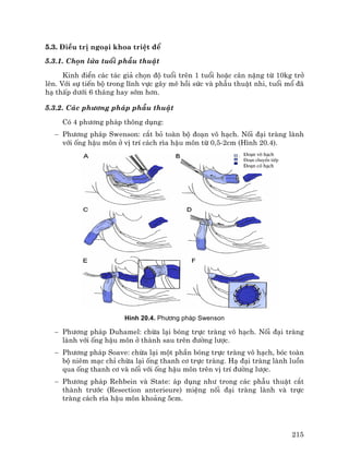 215
§o¹n v« h¹ch
§o¹n chuyÓn tiÕp
§o¹n cã h¹ch
5.3. §iÒu trÞ ngo¹i khoa triÖt ®Ó
5.3.1. Chän løa tuæi phÉu thuËt
Kinh ®iÓn c¸c t¸c gi¶ chän ®é tuæi trªn 1 tuæi hoÆc c©n nÆng tõ 10kg trë
lªn. Víi sù tiÕn bé trong lÜnh vùc g©y mª håi søc vµ phÉu thuËt nhi, tuæi mæ ®·
h¹ thÊp d−íi 6 th¸ng hay sím h¬n.
5.3.2. C¸c ph−¬ng ph¸p phÉu thuËt
Cã 4 ph−¬ng ph¸p th«ng dông:
− Ph−¬ng ph¸p Swenson: c¾t bá toµn bé ®o¹n v« h¹ch. Nèi ®¹i trµng lµnh
víi èng hËu m«n ë vÞ trÝ c¸ch r×a hËu m«n tõ 0,5-2cm (H×nh 20.4).
H×nh 20.4. Ph−¬ng ph¸p Swenson
− Ph−¬ng ph¸p Duhamel: chõa l¹i bãng trùc trµng v« h¹ch. Nèi ®¹i trµng
lµnh víi èng hËu m«n ë thµnh sau trªn ®−êng l−îc.
− Ph−¬ng ph¸p Soave: chõa l¹i mét phÇn bãng trùc trµng v« h¹ch, bãc toµn
bé niªm m¹c chØ chõa l¹i èng thanh c¬ trùc trµng. H¹ ®¹i trµng lµnh luån
qua èng thanh c¬ vµ nèi víi èng hËu m«n trªn vÞ trÝ ®−êng l−îc.
− Ph−¬ng ph¸p Rehbein vµ State: ¸p dông nh− trong c¸c phÉu thuËt c¾t
thµnh tr−íc (Resection anterieure) miÖng nèi ®¹i trµng lµnh vµ trùc
trµng c¸ch r×a hËu m«n kho¶ng 5cm.
 