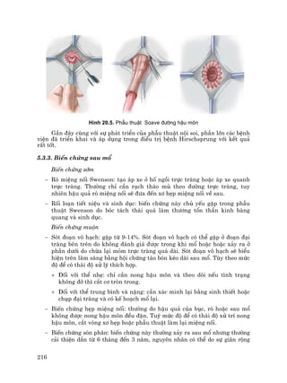 216
H×nh 20.5. PhÉu thuËt Soave ®−êng hËu m«n
GÇn ®©y cïng víi sù ph¸t triÓn cña phÉu thuËt néi soi, phÇn lín c¸c bÖnh
viÖn ®· triÓn khai vµ ¸p dông trong ®iÒu trÞ bÖnh Hirschsprung víi kÕt qu¶
rÊt tèt.
5.3.3. BiÕn chøng sau mæ
BiÕn chøng sím
− Rß miÖng nèi Swenson: t¹o ¸p xe ë hè ngåi trùc trµng hoÆc ¸p xe quanh
trùc trµng. Th−êng chØ cÇn r¹ch th¸o mñ theo ®−êng trùc trµng, tuy
nhiªn hËu qu¶ rß miÖng nèi sÏ ®−a ®Õn x¬ hÑp miÖng nèi vÒ sau.
− Rèi lo¹n tiÕt niÖu vµ sinh dôc: biÕn chøng nµy chñ yÕu gÆp trong phÉu
thuËt Swenson do bãc t¸ch th¸i qu¸ lµm th−¬ng tæn thÇn kinh bµng
quang vµ sinh dôc.
BiÕn chøng muén
− Sãt ®o¹n v« h¹ch: gÆp tõ 9-14%. Sãt ®o¹n v« h¹ch cã thÓ gÆp ë ®o¹n ®¹i
trµng bªn trªn do kh«ng ®¸nh gi¸ ®−îc trong khi mæ hoÆc hoÆc x¶y ra ë
phÇn d−íi do chõa l¹i mám trùc trµng qu¸ dµi. Sãt ®o¹n v« h¹ch sÏ biÓu
hiÖn trªn l©m sµng b»ng héi chøng t¸o bãn kÐo dµi sau mæ. Tïy theo møc
®é ®Ó cã th¸i ®é xö lý thÝch hîp.
+ §èi víi thÓ nhÑ: chØ cÇn nong hËu m«n vµ theo dâi nÕu t×nh tr¹ng
kh«ng ®ì th× c¾t c¬ trßn trong.
+ §èi víi thÓ trung b×nh vµ nÆng: cÇn x¸c minh l¹i b»ng sinh thiÕt hoÆc
chôp ®¹i trµng vµ cã kÕ ho¹ch mæ l¹i.
− BiÕn chøng hÑp miÖng nèi: th−êng do hËu qu¶ cña bôc, rß hoÆc sau mæ
kh«ng ®−îc nong hËu m«n ®Òu ®Æn. Tuú møc ®é ®Ó cã th¸i ®é xö trÝ nong
hËu m«n, c¾t vßng x¬ hÑp hoÆc phÉu thuËt lµm l¹i miÖng nèi.
− BiÕn chøng sãn ph©n: biÕn chøng nµy th−êng x¶y ra sau mæ nh−ng th−êng
c¶i thiÖn dÇn tõ 6 th¸ng ®Õn 3 n¨m, nguyªn nh©n cã thÓ do sù gi·n réng
 