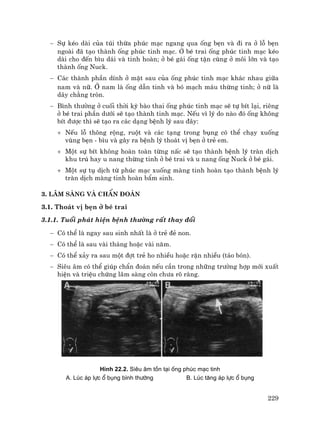 229
− Sù kÐo dµi cña tói thõa phóc m¹c ngang qua èng bÑn vµ ®i ra ë lç bÑn
ngoµi ®· t¹o thµnh èng phóc tinh m¹c. ë bÐ trai èng phóc tinh m¹c kÐo
dµi cho ®Õn b×u d¸i vµ tinh hoµn; ë bÐ g¸i èng tËn cïng ë m«i lín vµ t¹o
thµnh èng Nuck.
− C¸c thµnh phÇn dÝnh ë mÆt sau cña èng phóc tinh m¹c kh¸c nhau gi÷a
nam vµ n÷. ë nam lµ èng dÉn tinh vµ bã m¹ch m¸u thõng tinh; ë n÷ lµ
d©y ch»ng trßn.
− B×nh th−êng ë cuèi thêi kú bµo thai èng phóc tinh m¹c sÏ tù bÝt l¹i, riªng
ë bÐ trai phÇn d−íi sÏ t¹o thµnh tinh m¹c. NÕu v× lý do nµo ®ã èng kh«ng
bÝt ®−îc th× sÏ t¹o ra c¸c d¹ng bÖnh lý sau ®©y:
+ NÕu lç th«ng réng, ruét vµ c¸c t¹ng trong bông cã thÓ ch¹y xuèng
vïng bÑn - b×u vµ g©y ra bÖnh lý tho¸t vÞ bÑn ë trÎ em.
+ Mét sù bÝt kh«ng hoµn toµn tõng nÊc sÏ t¹o thµnh bÖnh lý trµn dÞch
khu tró hay u nang thõng tinh ë bÐ trai vµ u nang èng Nuck ë bÐ g¸i.
+ Mét sù tô dÞch tõ phóc m¹c xuèng mµng tinh hoµn t¹o thµnh bÖnh lý
trµn dÞch mµng tinh hoµn bÈm sinh.
3. L©m sµng vµ chÈn ®o¸n
3.1. Tho¸t vÞ bÑn ë bÐ trai
3.1.1. Tuæi ph¸t hiÖn bÖnh th−êng rÊt thay ®æi
− Cã thÓ lµ ngay sau sinh nhÊt lµ ë trÎ ®Î non.
− Cã thÓ lµ sau vµi th¸ng hoÆc vµi n¨m.
− Cã thÓ x¶y ra sau mét ®ît trÎ ho nhiÒu hoÆc rÆn nhiÒu (t¸o bãn).
− Siªu ©m cã thÓ gióp chÈn ®o¸n nÕu cÇn trong nh÷ng tr−êng hîp míi xuÊt
hiÖn vµ triÖu chøng l©m sµng cßn ch−a râ rµng.
H×nh 22.2. Siªu ©m tån t¹i èng phóc m¹c tinh
A. Lóc ¸p lùc æ bông b×nh th−êng B. Lóc t¨ng ¸p lùc æ bông
 