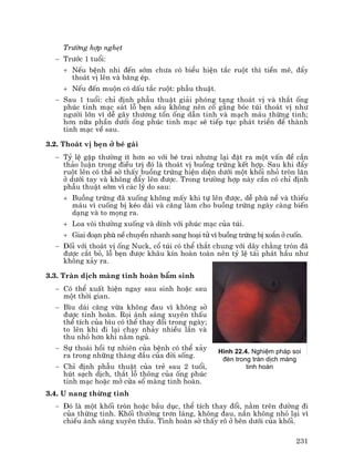 231
Tr−êng hîp nghÑt
− Tr−íc 1 tuæi:
+ NÕu bÖnh nhi ®Õn sím ch−a cã biÓu hiÖn t¾c ruét th× tiÒn mª, ®Èy
tho¸t vÞ lªn vµ b¨ng Ðp.
+ NÕu ®Õn muén cã dÊu t¾c ruét: phÉu thuËt.
− Sau 1 tuæi: chØ ®Þnh phÉu thuËt gi¶i phãng t¹ng tho¸t vÞ vµ th¾t èng
phóc tinh m¹c s¸t lç bÑn s©u kh«ng nªn cè g¾ng bãc tói tho¸t vÞ nh−
ng−êi lín v× dÔ g©y th−¬ng tæn èng dÉn tinh vµ m¹ch m¸u thõng tinh;
h¬n n÷a phÇn d−íi èng phóc tinh m¹c sÏ tiÕp tôc ph¸t triÓn ®Ó thµnh
tinh m¹c vÒ sau.
3.2. Tho¸t vÞ bÑn ë bÐ g¸i
− Tû lÖ gÆp th−êng Ýt h¬n so víi bÐ trai nh−ng l¹i ®Æt ra mét vÊn ®Ò cÇn
th¶o luËn trong ®iÒu trÞ ®ã lµ tho¸t vÞ buång trøng kÕt hîp. Sau khi ®Èy
ruét lªn cã thÓ sê thÊy buång trøng hiÖn diÖn d−íi mét khèi nhá trßn l¨n
ë d−íi tay vµ kh«ng ®Èy lªn ®−îc. Trong tr−êng hîp nµy cÇn cã chØ ®Þnh
phÉu thuËt sím v× c¸c lý do sau:
+ Buång trøng ®· xuèng kh«ng mÊy khi tù lªn ®−îc, dÔ phï nÒ vµ thiÕu
m¸u v× cuèng bÞ kÐo dµi vµ c¨ng lµm cho buång trøng ngµy cµng biÕn
d¹ng vµ to mäng ra.
+ Loa vßi th−êng xuèng vµ dÝnh víi phóc m¹c cña tói.
+ Giai ®o¹n phï nÒ chuyÓn nhanh sang ho¹i tö v× buång trøng bÞ xo¾n ë cuèn.
− §èi víi tho¸t vÞ èng Nuck, cæ tói cã thÓ th¾t chung víi d©y ch»ng trßn ®·
®−îc c¾t bá, lç bÑn ®−îc kh©u kÝn hoµn toµn nªn tû lÖ t¸i ph¸t hÇu nh−
kh«ng x¶y ra.
3.3. Trµn dÞch mµng tinh hoµn bÈm sinh
− Cã thÓ xuÊt hiÖn ngay sau sinh hoÆc sau
mét thêi gian.
− B×u d¸i c¨ng võa kh«ng ®au v× kh«ng sê
®−îc tinh hoµn. Räi ¸nh s¸ng xuyªn thÊu
thÓ tÝch cña b×u cã thÓ thay ®æi trong ngµy;
to lªn khi ®i l¹i ch¹y nh¶y nhiÒu lÇn vµ
thu nhá h¬n khi n»m ngñ.
− Sù tho¸i håi tù nhiªn cña bÖnh cã thÓ x¶y
ra trong nh÷ng th¸ng ®Çu cña ®êi sèng.
− ChØ ®Þnh phÉu thuËt cña trÎ sau 2 tuæi,
hót s¹ch dÞch, th¾t lç th«ng cña èng phóc
tinh m¹c hoÆc më cöa sæ mµng tinh hoµn.
3.4. U nang thõng tinh
− §ã lµ mét khèi trßn hoÆc bÇu dôc, thÓ tÝch thay ®æi, n»m trªn ®−êng ®i
cña thõng tinh. Khèi th−êng tr¬n l¸ng, kh«ng ®au, n¾n kh«ng nhá l¹i v×
chiÕu ¸nh s¸ng xuyªn thÊu. Tinh hoµn sê thÊy râ ë bªn d−íi cña khèi.
H×nh 22.4. NghiÖm ph¸p soi
®Ìn trong trµn dÞch mµng
tinh hoµn
 