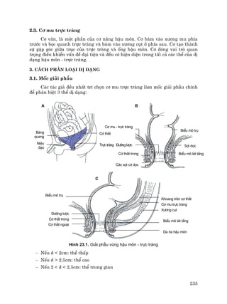 235
2.3. C¬ mu trùc trµng
C¬ v©n, lµ mét phÇn cña c¬ n©ng hËu m«n. C¬ b¸m vµo x−¬ng mu phÝa
tr−íc vµ bäc quanh trùc trµng vµ b¸m vµo x−¬ng côt ë phÝa sau. C¬ t¹o thµnh
sù gËp gãc gi÷a trôc cña trùc trµng vµ èng hËu m«n. C¬ ®ãng vai trß quan
träng ®iÒu khiÓn vÊn ®Ò ®¹i tiÖn vµ ®Òu cã hiÖn diÖn trong tÊt c¶ c¸c thÓ cña dÞ
d¹ng hËu m«n - trùc trµng.
3. C¸ch ph©n lo¹i dÞ d¹ng
3.1. Mèc gi¶i phÉu
C¸c t¸c gi¶ ®Òu nhÊt trÝ chän c¬ mu trùc trµng lµm mèc gi¶i phÉu chÝnh
®Ó ph©n biÖt 3 thÓ dÞ d¹ng:
H×nh 23.1. Gi¶i phÉu vïng hËu m«n - trùc trµng
− NÕu d < 2cm: thÓ thÊp
− NÕu d > 2,5cm: thÓ cao
− NÕu 2 < d < 2,5cm: thÓ trung gian
Bµng
quang
NiÖu
®¹o
C¬ mu - trùc trµng
C¬ th¾t
Trùctrµng §−êngl−îc
C¬ th¾t trong
BiÓu m« trô
BiÓu m« trô
BiÓu m« l¸t tÇng
C¸c sîi c¬ däc
§−êng l−îc
C¬ th¾t trong
C¬ th¾t ngoµi
Khoang trªn c¬ th¾t
C¬ mu trùc trµng
X−¬ng côt
BiÓu m« l¸t tÇng
Da r×a hËu m«n
Sîi däc
BA
C
 