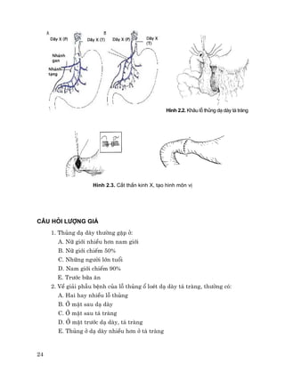 24
H×nh 2.2. Kh©u lç thñng d¹ dµy t¸ trµng
H×nh 2.3. C¾t thÇn kinh X, t¹o h×nh m«n vÞ
C¢U HáI L¦îNG GI¸
1. Thñng d¹ dµy th−êng gÆp ë:
A. N÷ giíi nhiÒu h¬n nam giíi
B. N÷ giíi chiÕm 50%
C. Nh÷ng ng−êi lín tuæi
D. Nam giíi chiÕm 90%
E. Tr−íc b÷a ¨n
2. VÒ gi¶i phÉu bÖnh cña lç thñng æ loÐt d¹ dµy t¸ trµng, th−êng cã:
A. Hai hay nhiÒu lç thñng
B. ë mÆt sau d¹ dµy
C. ë mÆt sau t¸ trµng
D. ë mÆt tr−íc d¹ dµy, t¸ trµng
E. Thñng ë d¹ dµy nhiÒu h¬n ë t¸ trµng
 