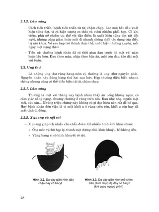 28
2.1.2. L©m sµng
− C¸ch tiÕn triÓn: bÖnh tiÕn triÓn tõ tõ, chËm ch¹p. Lóc míi b¾t ®Çu xuÊt
hiÖn tõng ®ît, v× cã hiÖn t−îng co th¾t vµ viªm nhiÔm phèi hîp. Cã khi
viªm, phï nÒ chiÕm −u thÕ víi ®Æc ®iÓm lµ xuÊt hiÖn tõng ®ît rÊt ®ét
ngét, nh−ng còng gi¶m hoÆc mÊt ®i nhanh chãng d−íi t¸c dông cña ®iÒu
trÞ néi khoa. VÒ sau hÑp trë thµnh thùc thÓ, xuÊt hiÖn th−êng xuyªn, mçi
ngµy mét nÆng thªm.
− TiÒn sö: th−êng bÖnh nh©n ®· cã thêi gian ®au tr−íc ®ã mét vµi n¨m
hoÆc l©u h¬n. §au theo mïa, nhÞp theo b÷a ¨n, mçi c¬n ®au kÐo dµi mét
vµi tuÇn.
2.2. Ung th−
Lµ nh÷ng ung th− vïng hang-m«n vÞ, th−êng lµ ung tth− nguyªn ph¸t.
Nguyªn nh©n nµy ®øng hµng thø hai sau loÐt. HÑp th−êng diÔn biÕn nhanh
chãng nh−ng còng cã thÓ diÔn biÕn tõ tõ, chËm ch¹p.
2.2.1. L©m sµng
Th−êng lµ mét vµi th¸ng nay bÖnh nh©n thÊy ¨n uèng kh«ng ngon, cã
c¶m gi¸c n»ng nÆng, ch−¬ng ch−íng ë vïng trªn rèn. §au nhÌ nhÑ, ng−êi mÖt
mái, sót c©n... Nh÷ng triÖu chøng nµy kh«ng cã g× ®Æc hiÖu nªn rÊt dÔ bá qua.
Hay bÖnh nh©n ®Õn viÖn lµ v× mét khèi u ë vïng trªn rèn, khèi u cßn hay ®·
mÊt tÝnh di ®éng.
2.2.2. X quang vµ néi soi
− X quang gióp Ých nhiÒu cho chÈn ®o¸n. Cã nhiÒu h×nh ¶nh kh¸c nhau:
+ èng m«n vÞ chÝt hÑp l¹i thµnh mét ®−êng nhá, khóc khuûu, bê kh«ng ®Òu.
+ Vïng hang vÞ cã h×nh khuyÕt râ rÖt.
H×nh 3.2. D¹ dµy gi·n h×nh ®¸y
chËu dµy cã baryt
H×nh 3.3. D¹ dµy gi·n h×nh má chim
trªn phim chôp d¹ dµy cã baryt
(khi quay ng−îc phim)
 