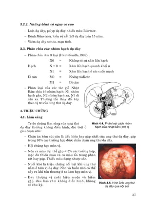 37
3.2.2. Nh÷ng bÖnh cã nguy c¬ cao
− LoÐt d¹ dµy, polyp d¹ dµy, thiÕu m¸u Biermer.
− BÖnh MÐnetrier, tiÒn sö c¾t 2/3 d¹ dµy h¬n 15 n¨m.
− Viªm d¹ dµy x¬ teo, m¹n tÝnh.
3.3. Ph©n chia c¸c nhãm h¹ch d¹ dµy
− Ph©n chia lµm 3 lo¹i (Hautefeuille,1982).
N0 = Kh«ng cã sù x©m lÊn h¹ch
H¹ch N + 0 = X©m lÊn h¹ch quanh khèi u
N1 = X©m lÊn h¹ch ë c¸c cuèn m¹ch
Di c¨n M0 = Kh«ng cã di c¨n
M1 = Di c¨n
− Ph©n lo¹i cña c¸c t¸c gi¶ NhËt
B¶n: chia 16 nhãm h¹ch: N1 nhãm
h¹ch gÇn, N2 nhãm h¹ch xa, N3 di
c¨n xa. Th−¬ng tæn thay ®æi tïy
theo vÞ trÝ cña ung th− d¹ dµy.
4. TriÖu chøng
4.1. L©m sµng
TriÖu chøng l©m sµng cña ung th−
d¹ dµy th−êng kh«ng ®iÓn h×nh, ®Æc biÖt ë
giai ®o¹n sím:
− Ch¸n ¨n kÌm sót c©n lµ dÊu hiÖu hay gÆp nhÊt cña ung th− d¹ dµy, gÆp
trong 95% c¸c tr−êng hîp ®−îc chÈn ®o¸n ung th− d¹ dµy.
− Héi chøng hÑp m«n vÞ.
− N«n ra m¸u ®¹i thÓ gÆp < 5% c¸c tr−êng hîp,
mÆc dï thiÕu m¸u vµ cã m¸u Èn trong ph©n
rÊt hay gÆp. ThiÕu m¸u d¹ng nh−îc s¾c.
− Nuèt khã lµ triÖu chøng næi bËt khi ung th−
n»m ë t©m vÞ d¹ dµy. N«n vµ buån n«n cã thÓ
x¶y ra khi tæn th−¬ng ë xa lµm hÑp m«n vÞ.
− §au th−îng vÞ xuÊt hiÖn muén vµ hiÕm
gÆp, ®au l©m r©m kh«ng ®iÓn h×nh, kh«ng
cã chu kú.
H×nh 4.4. Ph©n lo¹i c¸ch nhãm
h¹ch cña NhËt B¶n (1981)
H×nh 4.5. H×nh ¶nh ung th−
d¹ dµy qua néi soi
 