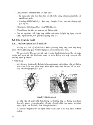 50
− Dïng c¸c ho¸ chÊt lµm tan sái mËt nh−:
+ Sö dông c¸c hãa chÊt lµm tan sái nh− cho uèng chenodeoxycholic vµ
ursodeoxycholic.
+ Hçn hîp MTBE (Methyl - Tertiary - Butyl - Ether) b¬m vµo ®−êng mËt
qua néi soi.
− Néi soi qua t¸ trµng, c¾t c¬ vßng Oddi lÊy sái.
− T¸n sái qua da, t¸n sái qua néi soi ®−êng mËt.
− T¸n sái ngoµi c¬ thÓ : hiÖn nay nhiÒu n−íc trªn thÕ giíi ¸p dông t¸n sái
OMC ngoµi c¬ thÓ, kÕt qu¶ thµnh c«ng kh¸ cao.
5.2. §iÒu trÞ phÉu thuËt
5.2.1. PhÉu thuËt kinh ®iÓn (mæ hë)
Më èng mËt chñ lÊy sái dÉn l−u Kehr: ph−¬ng ph¸p nµy tr−íc ®©y ®ang
®−îc sö dông th−êng quy ®Ó ®iÒu trÞ ngo¹i khoa sái èng mËt chñ.
Tõ xa x−a cho ®Õn nay vÊn ®Ò chñ yÕu vÉn lµ ph−¬ng ph¸p ®iÒu trÞ phÉu
thuËt, mæ bông vµ tiÕn hµnh c¸c thao t¸c trªn ®−êng mËt tuú theo c¸c tæn
th−¬ng bÖnh lý cña nã.
• ChØ ®Þnh
− Mæ cÊp cøu: th−êng chØ ®Þnh trªn bÖnh nh©n cã biÕn chøng cña sái ®−êng
mËt: nh− thÊm mËt phóc m¹c, viªm phóc m¹c mËt do ho¹i tö tói mËt,
ho¹i tö ®−êng mËt ngoµi gan...
H×nh 5.7. DÉn l−u tói mËt
− Mæ cÊp cøu tr× ho·n: chØ ®Þnh trong c¸c tr−êng hîp sái ®−êng mËt kÌm
theo sèc nhiÔm trïng cÇn ph¶i håi søc néi mét thêi gian ng¾n, khi t×nh
tr¹ng bÖnh t¹m æn ®Þnh, thùc hiÖn phÉu thuËt.
− Mæ theo kÕ ho¹ch: ®−îc chØ ®Þnh ë c¸c bÖnh nh©n cã sái mËt ch−a cã biÕn
chøng.
 