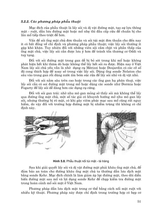 51
5.2.2. C¸c ph−¬ng ph¸p phÉu thuËt
Môc ®Ých cña phÉu thuËt lµ lÊy sái vµ dÞ vËt ®−êng mËt, t¹o sù l−u th«ng
mËt - ruét, dÉn l−u ®−êng mËt hoÆc mæ nhÑ th× ®Çu cÊp cøu ®Ó chuÈn bÞ cho
lÇn mæ tiÕp theo triÖt ®Ó h¬n.
VÊn ®Ò sái èng mËt chñ ®¬n thuÇn vµ sái tói mËt ®¬n thuÇn cho ®Õn nay
Ýt cã bÊt ®ång vÒ chØ ®Þnh vµ ph−¬ng ph¸p phÉu thuËt; viÖc lÊy sái th−êng Ýt
gÆp khã kh¨n. Tuy nhiªn ®èi víi nh÷ng viªn sái c¾m chÆt vµ phÇn thÊp cña
èng mËt chñ, viÖc lÊy sái cÇn ®−îc l−u ý h¬n ®Ó tr¸nh tæn th−¬ng c¬ Oddi vµ
tuþ t¹ng.
§èi víi sái ®−êng mËt trong gan dÔ bÞ bá sãt trong khi mæ hoÆc kh«ng
ph¸t hiÖn hÕt khi th¨m dß hoÆc kh«ng thÓ lÊy hÕt sái ra ®−îc. HiÖn nay ë ViÖt
Nam lÊy sái chñ yÕu vÉn lµ nhê dông cô MÐrizzi hoÆc Desjardin cã c¸c cì sè
®é cong thÝch hîp ®Ó xoay së trong viÖc lÊy sái. Dïng èng sonde Nelaton cho
s©u vµo trong gan råi dïng n−íc Êm b¬m sóc röa ®Ó lÊy sái nhá vµ dÞ vËt nhá.
§èi víi sái n»m s©u trªn cao hoÆc trong c¸c èng gan h¹ ph©n thuú, viÖc
lÊy sái cÇn cã soi ®−êng mËt trong mæ hoÆc dïng c¸c sonde nh− Dormia hoÆc
Fogarty ®Ó lÊy sái dÔ dµng h¬n c¸c dông cô cøng.
§èi víi sái gan tr¸i: nhê nhu m« gan máng sê thÊy sái mµ kh«ng thÓ lÊy
qua ®−êng èng mËt chñ, mét sè t¸c gi¶ cã khuynh h−íng më nhu m« gan lÊy
sái, nh−ng th−êng bÞ rß mËt, cã khi g©y viªm phóc m¹c sau mæ còng rÊt nguy
hiÓm, do vËy ®èi víi tr−êng hîp ®−êng mËt bÞ nhiÔm trïng th× kh«ng cã chØ
®Þnh nµy.
H×nh 5.8. PhÉu thuËt nèi tói mËt - t¸ trµng
Sau khi gi¶i quyÕt lÊy sái vµ dÞ vËt ®−êng mËt ph¶i kh©u èng mËt chñ, ®Ó
®¶m b¶o an toµn cho ®−êng kh©u èng mËt chñ ta th−êng dÉn l−u dÞch mËt
b»ng sonde Kehr. Môc ®Ých chÝnh lµ lµm gi¶m ¸p lùc ®−êng mËt, theo dâi diÔn
biÕn ®−êng mËt sau mæ vµ lîi dông sonde Kehr ®Ó chôp kiÓm tra ®−êng mËt
trong hoµn c¶nh mæ sái mËt ë ViÖt Nam.
Ph−¬ng ph¸p dÉn l−u dÞch mËt trong c¬ thÓ b»ng c¸ch nèi mËt ruét víi
nhiÒu kü thuËt. Ph−¬ng ph¸p nµy ®−îc chØ ®Þnh trong tr−êng hîp cã hÑp c¬
 