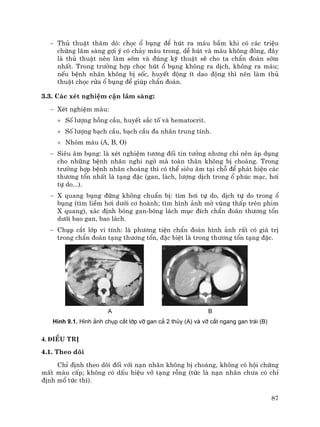 87
− Thñ thuËt th¨m dß: chäc æ bông ®Ó hót ra m¸u bÇm khi cã c¸c triÖu
chøng l©m sµng gîi ý cã ch¶y m¸u trong, dÔ hót vµ m¸u kh«ng ®«ng, ®©y
lµ thñ thuËt nªn lµm sím vµ ®óng kü thuËt sÏ cho ta chÈn ®o¸n sím
nhÊt. Trong tr−êng hîp chäc hót æ bông kh«ng ra dÞch, kh«ng ra m¸u;
nÕu bÖnh nh©n kh«ng bÞ sèc, huyÕt ®éng Ýt dao ®éng th× nªn lµm thñ
thuËt chäc röa æ bông ®Ó gióp chÈn ®o¸n.
3.3. C¸c xÐt nghiÖm cËn l©m sµng:
− XÐt nghiÖm m¸u:
+ Sè l−îng hång cÇu, huyÕt s¾c tè vµ hematocrit.
+ Sè l−îng b¹ch cÇu, b¹ch cÇu ®a nh©n trung tÝnh.
+ Nhãm m¸u (A, B, O)
− Siªu ©m bông: lµ xÐt nghiÖm t−¬ng ®èi tin t−ëng nh−ng chØ nªn ¸p dông
cho nh÷ng bÖnh nh©n nghi ngê mµ toµn th©n kh«ng bÞ cho¸ng. Trong
tr−êng hîp bÖnh nh©n cho¸ng th× cã thÓ siªu ©m t¹i chç ®Ó ph¸t hiÖn c¸c
th−¬ng tæn nhÊt lµ t¹ng ®Æc (gan, l¸ch, l−îng dÞch trong æ phóc m¹c, h¬i
tù do...).
− X quang bông ®øng kh«ng chuÈn bÞ: t×m h¬i tù do, dÞch tù do trong æ
bông (t×m liÒm h¬i d−íi c¬ hoµnh; t×m h×nh ¶nh mê vïng thÊp trªn phim
X quang), x¸c ®Þnh bãng gan-bãng l¸ch môc ®Ých chÈn ®o¸n th−¬ng tæn
d−íi bao gan, bao l¸ch.
− Chôp c¾t líp vi tÝnh: lµ ph−¬ng tiÖn chÈn ®o¸n h×nh ¶nh rÊt cã gi¸ trÞ
trong chÈn ®o¸n t¹ng th−¬ng tæn, ®Æc biÖt lµ trong th−¬ng tæn t¹ng ®Æc.
A B
H×nh 9.1. H×nh ¶nh chôp c¾t líp vì gan c¶ 2 thïy (A) vµ vì c¾t ngang gan tr¸i (B)
4. §iÒu trÞ
4.1. Theo dâi
ChØ ®Þnh theo dâi ®èi víi n¹n nh©n kh«ng bÞ cho¸ng, kh«ng cã héi chøng
mÊt m¸u cÊp; kh«ng cã dÊu hiÖu vì t¹ng rçng (tøc lµ n¹n nh©n ch−a cã chØ
®Þnh mæ tøc th×).
 
